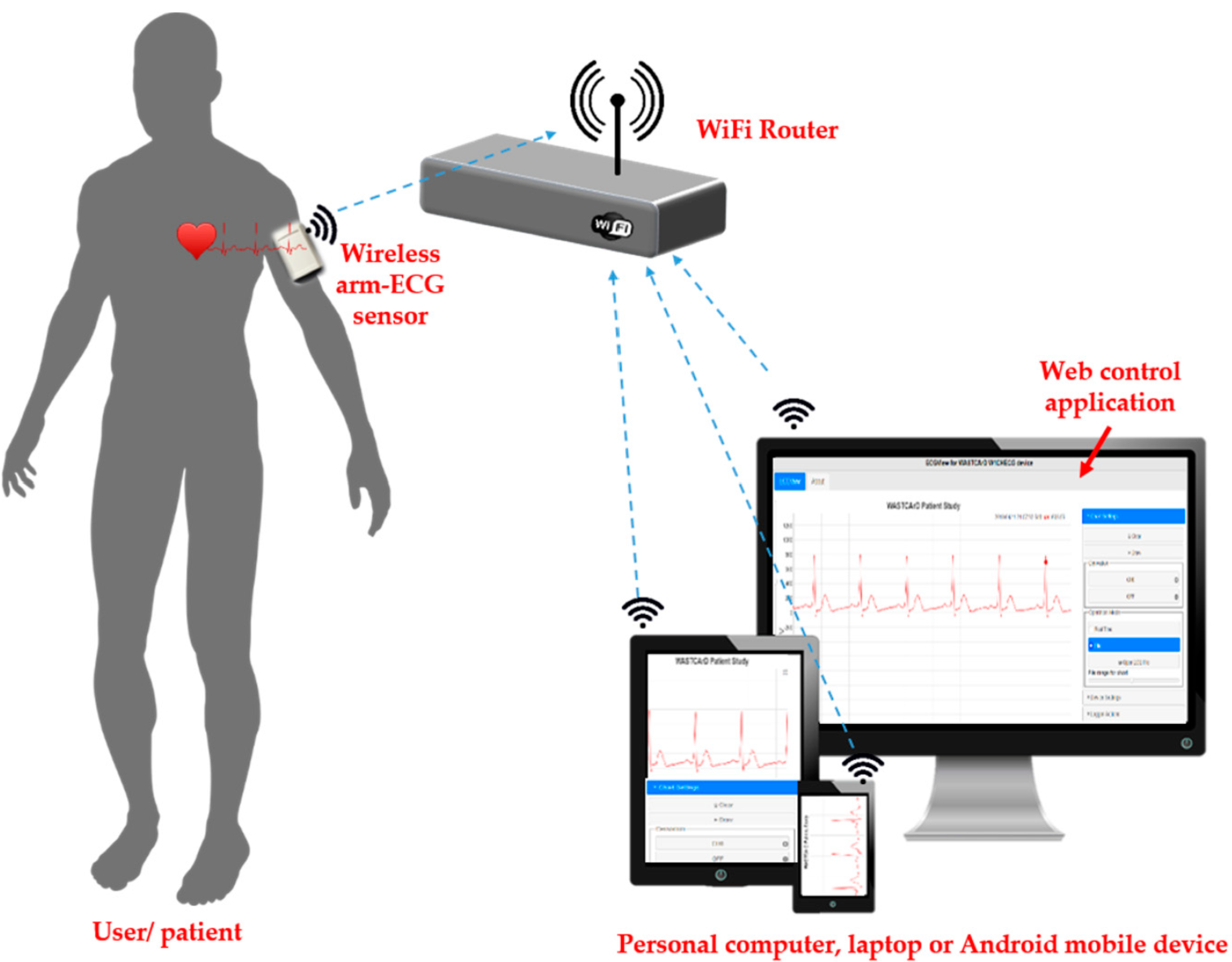 Wireless ECG Monitoring System